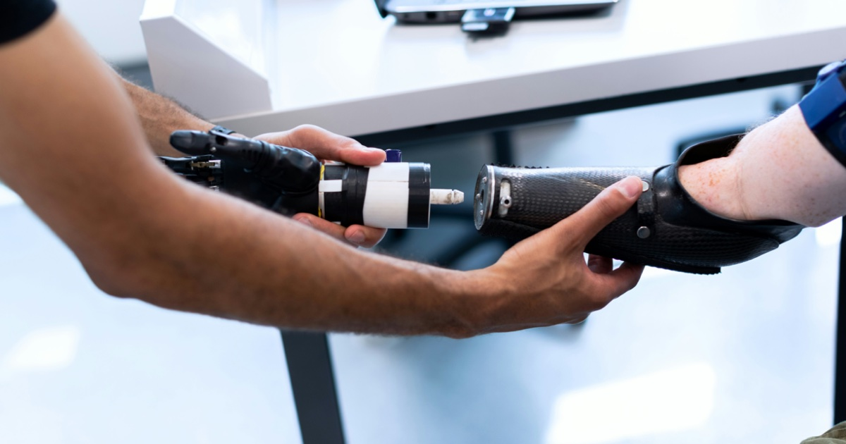 AI prosthetics- a better future for differently abled